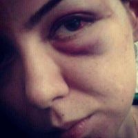 آیا عکس آزاده نامداری مربوط به تصادف بوده است