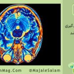 کشف منشأ دوگانه شکل‌گیری مغز انسان
