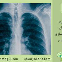 ارتباط پرتوهای یون‌ساز با فعال‌سازی ویژگی‌های کلیدی آلزایمر در مغز