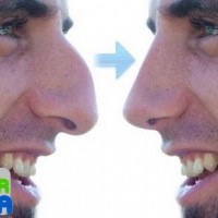 دانلود برنامه Plastic Surgery Simulator برای اندروید